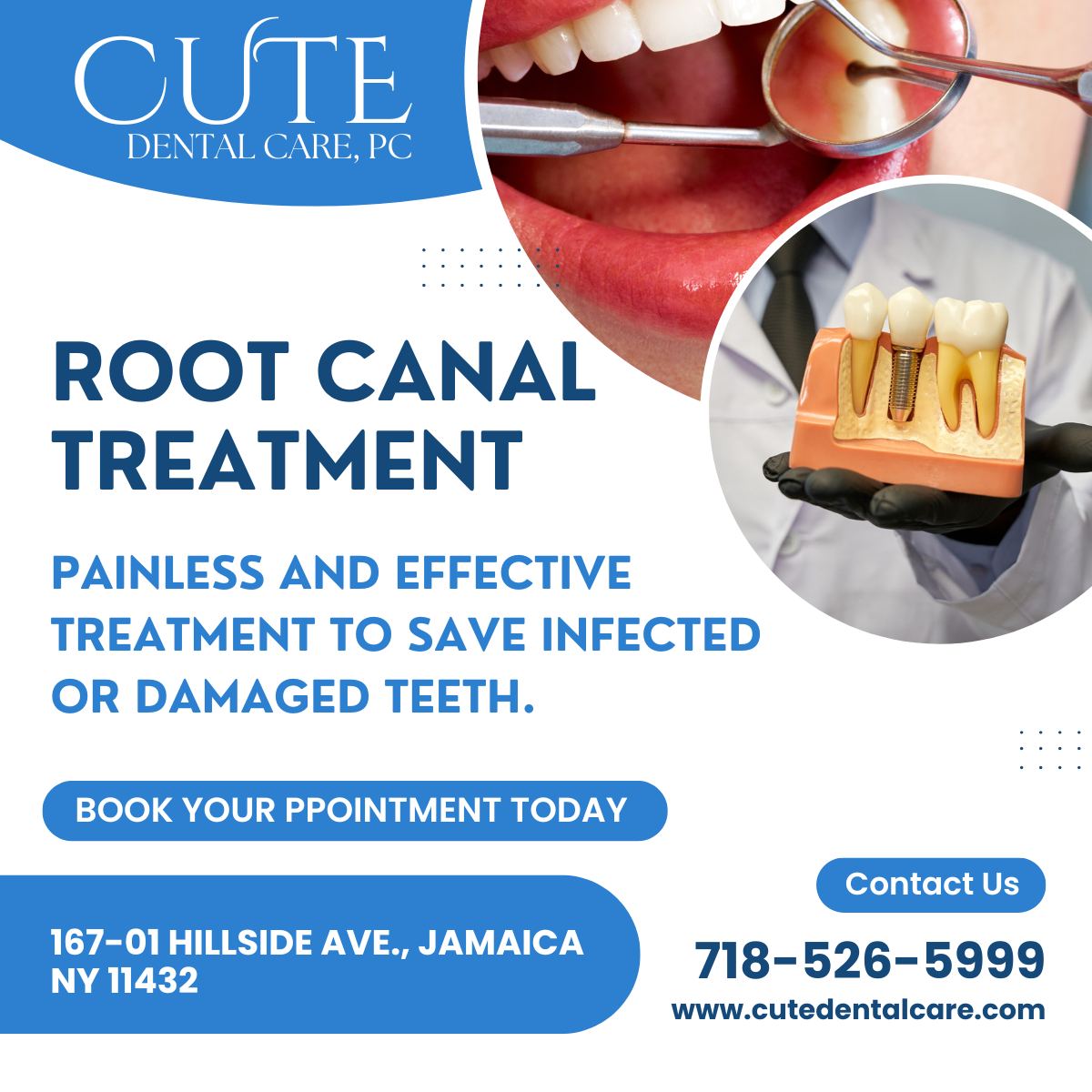 Get painless and effective root canal treatment in Jamaica, NY at Cute Dental Care, PC. Save infected teeth with modern dental technology. Call 718-526-5999 today!